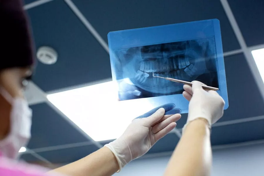 Dental X-Ray